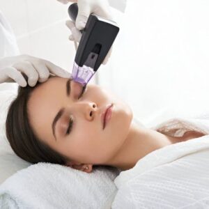 Morpheus8 / RF Microneedling