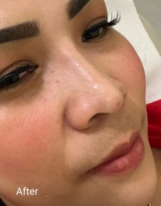 after e - About.Skin Dubai